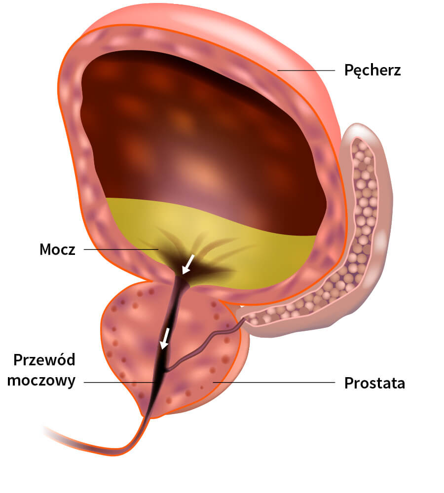 Prostata - grafika